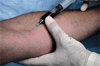recherche most cancers peau